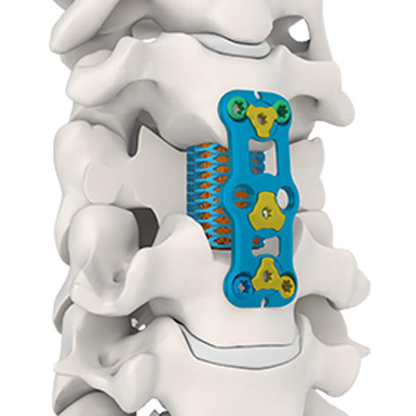 Pelat tulang belakang serviks anterior ⅳ
